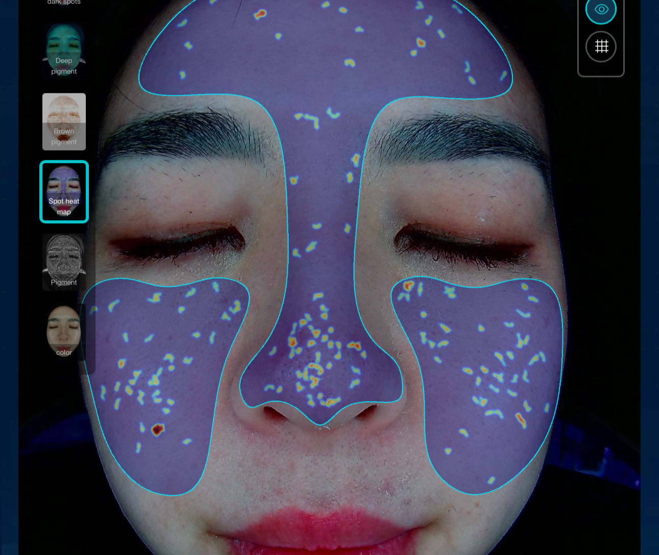 3D Ai Diagnostika pleti